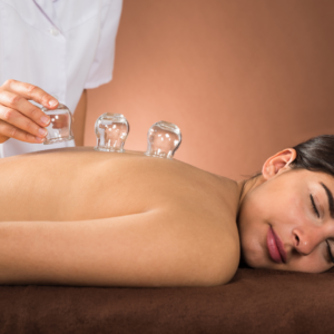 Cupping treatment near me